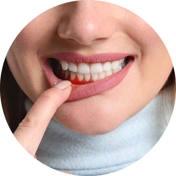 Баннер Рецессия десны Баннер Рецессия десны